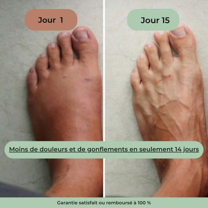 Masseur Thérapeutique Anti-Douleur GN