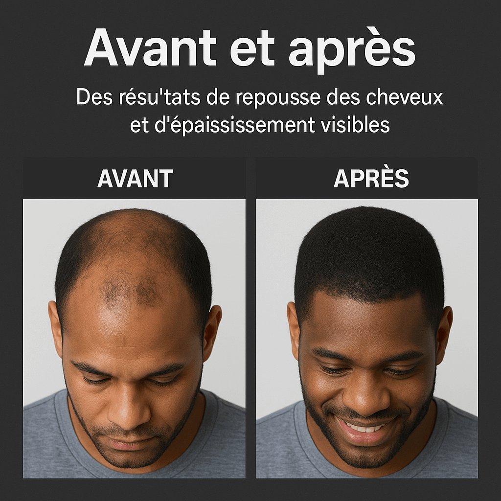 Shampoing activateur de racines GN