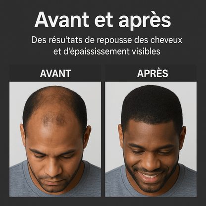 Shampoing activateur de racines GN